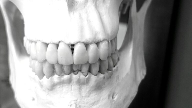 A dentist examines an implant-supported crown while a patient holds a dental cleaning brush.